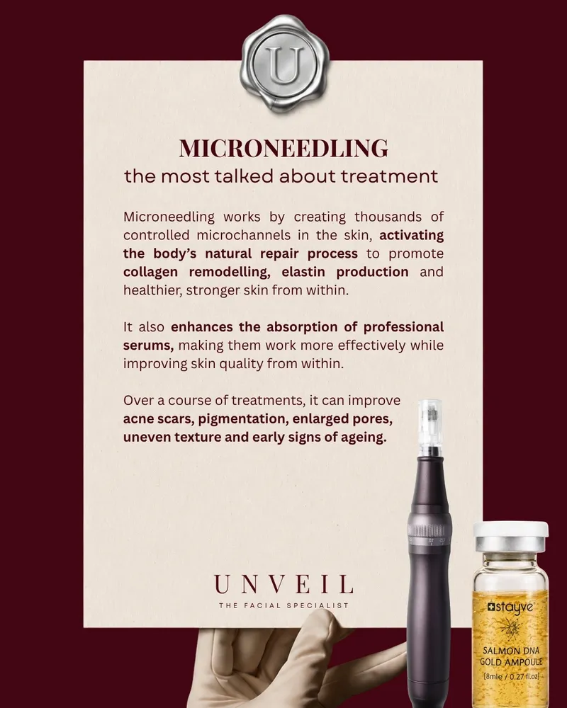Microneedling collagen-boosting treatment at Unveil The Facial Specialist Harrow